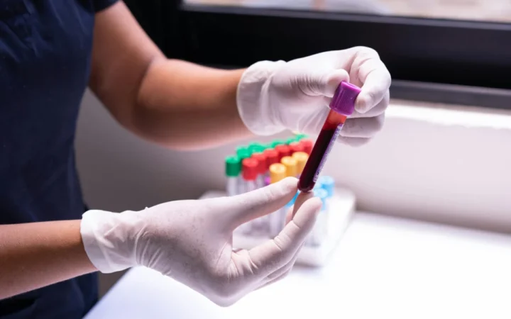 Gingiile care sângerează: semnul ascuns al diabetului, bolilor de inimă și Alzheimer