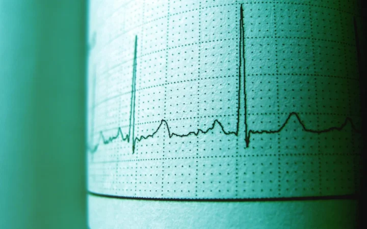 Criză cardiacă în America: 61% dintre adulți, afectați de boli cardiovasculare!