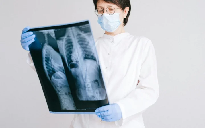 Tuberculoza revine în Cehia: Okamura solicită măsuri urgente împotriva creșterii cazurilor